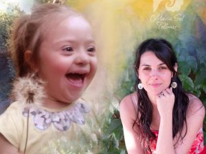 44-sindrome de down